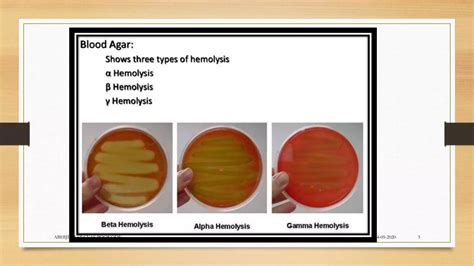 Understanding Hemolysis Types on Blood Agar Plates.